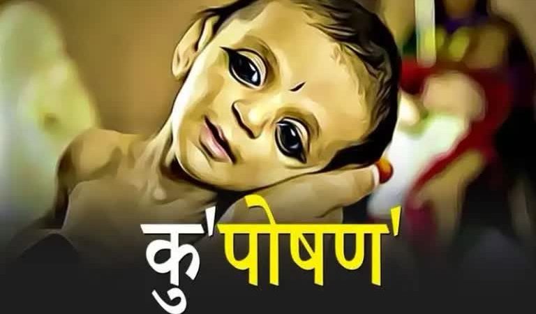 समस्या: कुपोषण की भयावह समस्या से जूझती पूरी दुनिया