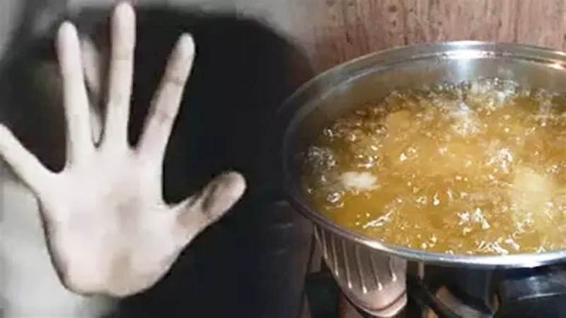 बेरहमी: आपसी विवाद में महिला पर फेंक दिया खौलता तेल, घायल की हालत गंभीर