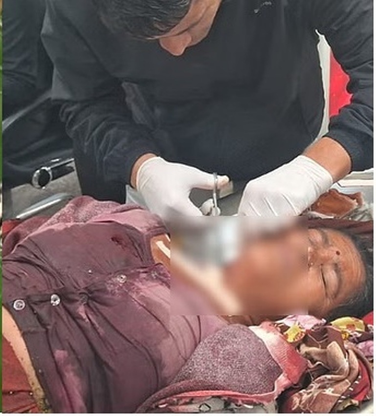 दहशत: शौच के लिए जा रही महिला पर गुलदार ने किया हमला, घायल की हालत गंभीर
