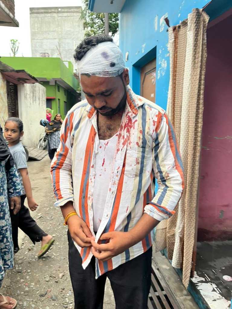  सत्ता मद: पैसे मांगने पर भाजपा नेता ने फोड़ा चाऊमीन विक्रेता का सिर, मामला दर्ज