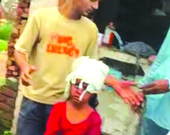 चोरी के दौरान बदमाशों ने बच्ची पर किया हमला, गंभीर