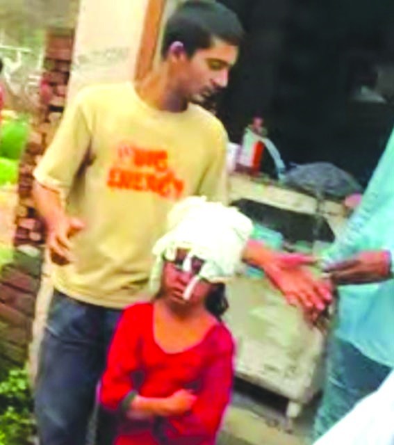 चोरी के दौरान बदमाशों ने बच्ची पर किया हमला, गंभीर