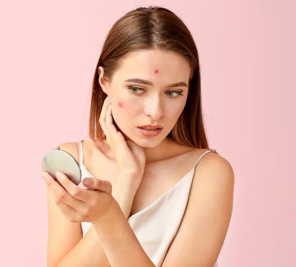 हैल्थ टिप्स: कोई माइस्चराइजर या महंगी क्रीम नहीं, बस कैस्टर आयल  का इस्तेमाल करें और मुंहासों और दाग-धब्बों से दूर रहें