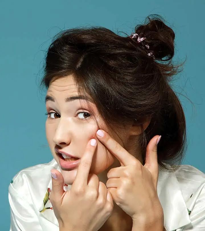 हैल्थ टिप्स: चेहरे पर मुंहासे हो गए हैं? इन 5 प्राकृतिक तरीकों से जल्द पाएं छुटकारा