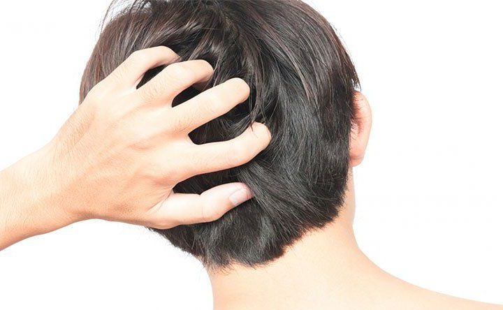 हैल्थ टिप्स: क्या आपको भी सिर की खुजली परेशान करती है?  ऐसे पाएं छुटकारा…