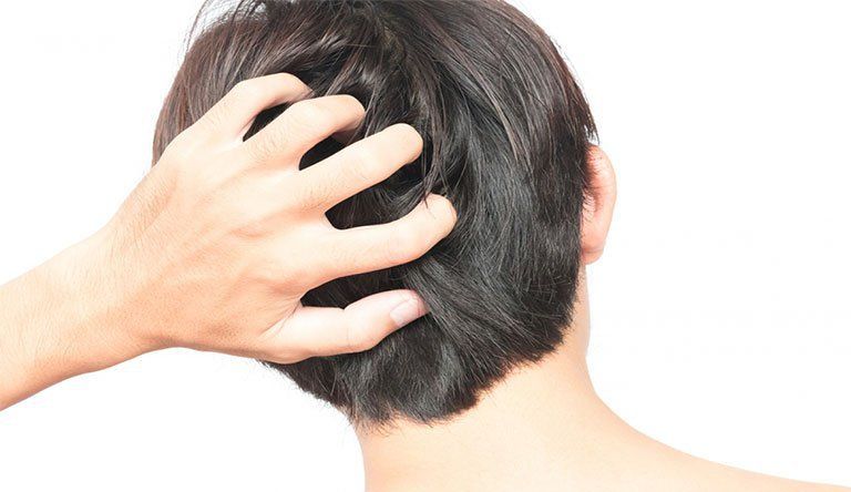 हैल्थ टिप्स: क्या आपको भी सिर की खुजली परेशान करती है?  ऐसे पाएं छुटकारा…
