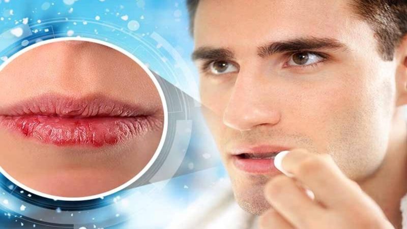 देखभाल: होंठों की देखभाल करते समय न करें ये 5 गलतियां, लग सकती है चोट