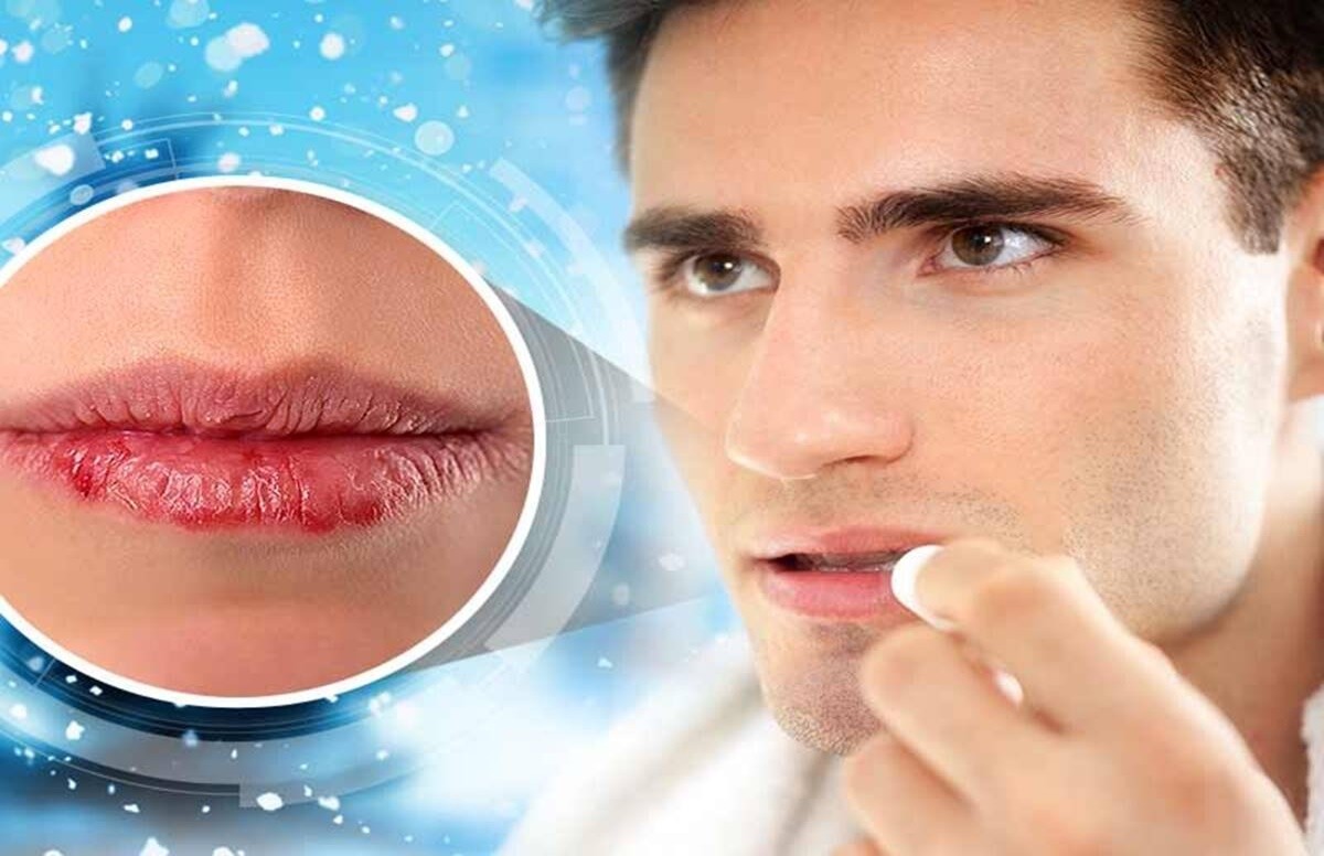 देखभाल: होंठों की देखभाल करते समय न करें ये 5 गलतियां, लग सकती है चोट
