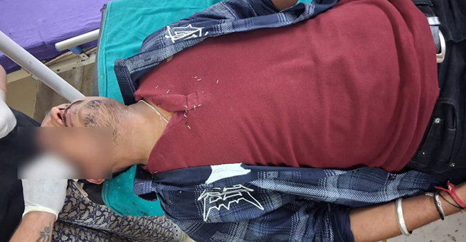 हेकड़ी: वोट देने जा रहे छात्र को चेकिंग के लिए रोका तो बोतल मारकर फोड़ दिया कर्मचारी का सिर